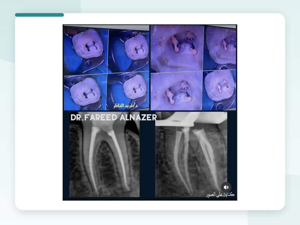 قبل وبعد | Before & After — Privea Dent