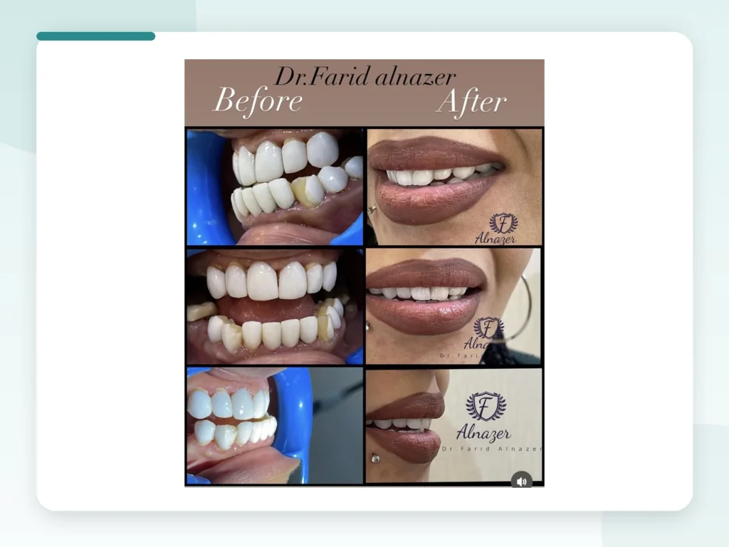 قبل وبعد | Before & After — Privea Dent